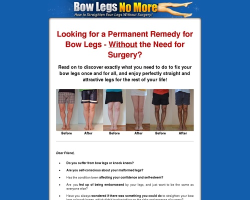Bow Legs No More – How to Straighten Your Legs Without Surgery! – Health & Fitness